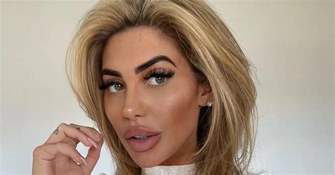 Geordie Shore's Chloe Ferry opens up about plastic .